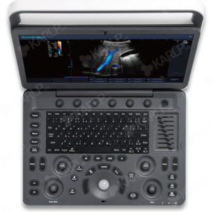 SONOSCAPE E2 ULTRASOUND MACHINE